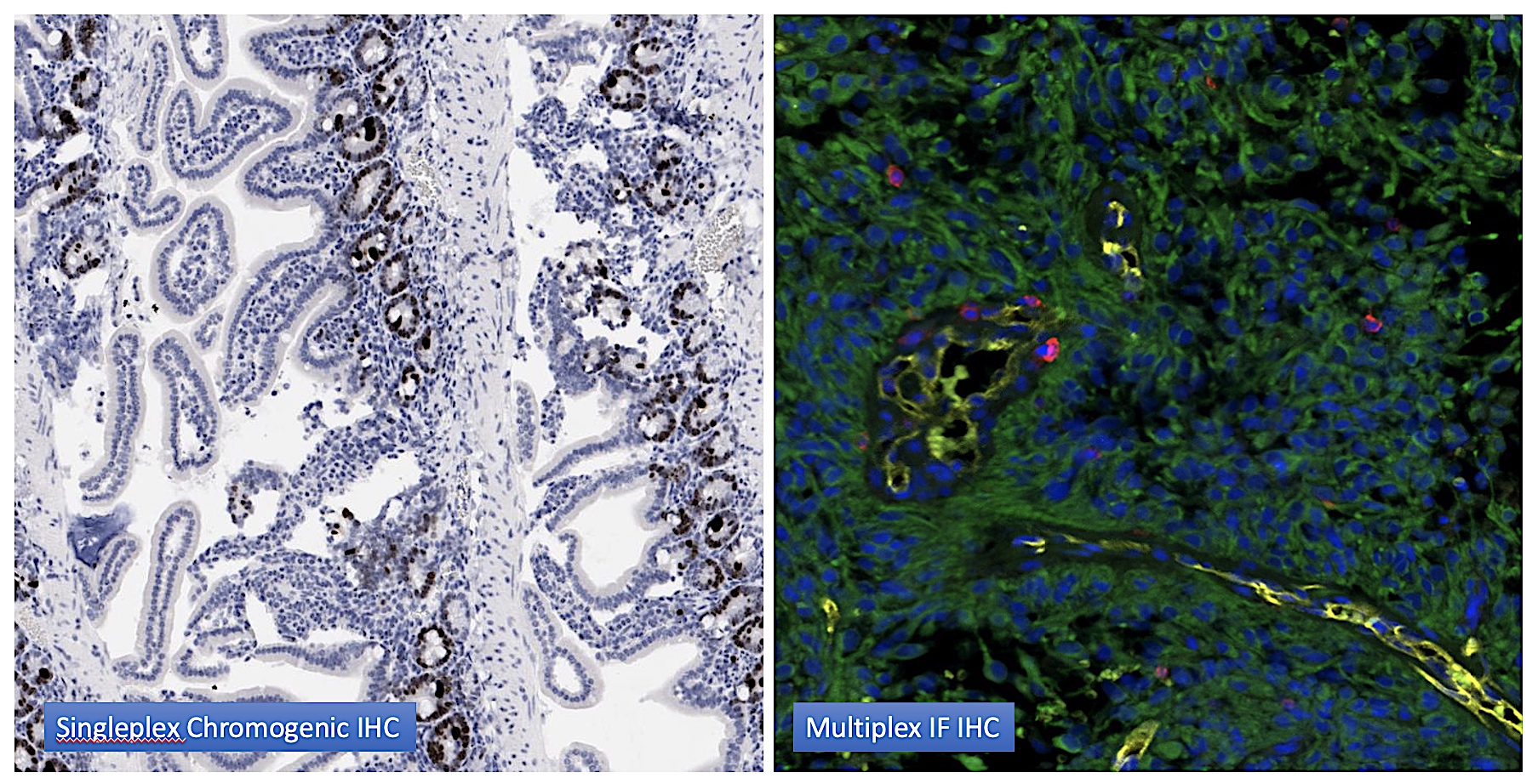 Immunohistochemistry And In Situ Hybridization | UK Healthcare